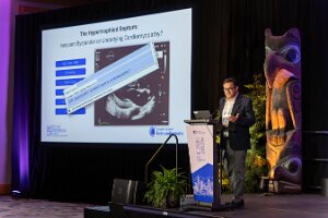 Tournoux 4 Featured Symposium April 30